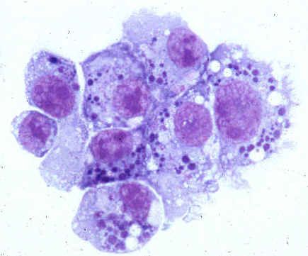 Årsaksfaktorer for menneskelig anaplasmose (familie Anaplasmataceae)