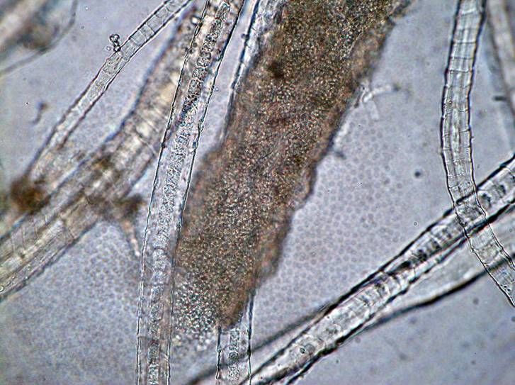 Patogener av epidermofytose